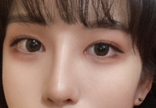 [眼睛] 白玉糯米 - 眼睛、鼻子、輪廓三種、額頭拉皮