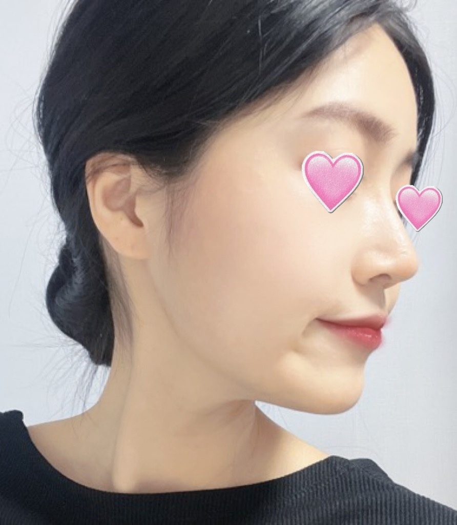 [鼻] Baby Fox - 鼻