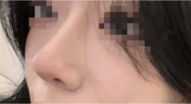 [鼻] 玻璃碎片 - 鼻