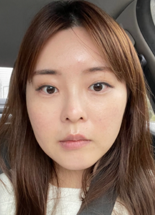 [顏面輪廓] Dr. Moia - 眼部、輪廓、鼻部、臉部抽脂