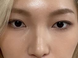 [鼻] 팡파레 - 鼻