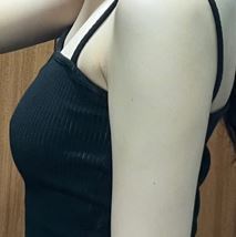 [隆胸] 玉米鬚茶 - 胸部