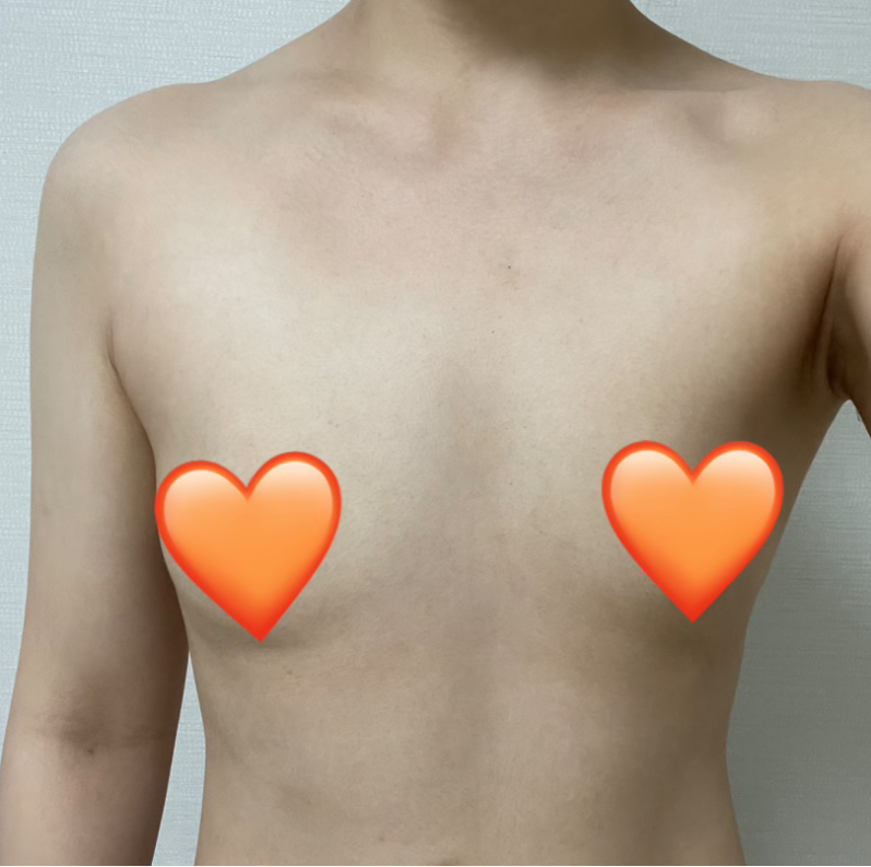 [胸部] 센트리 - 胸部