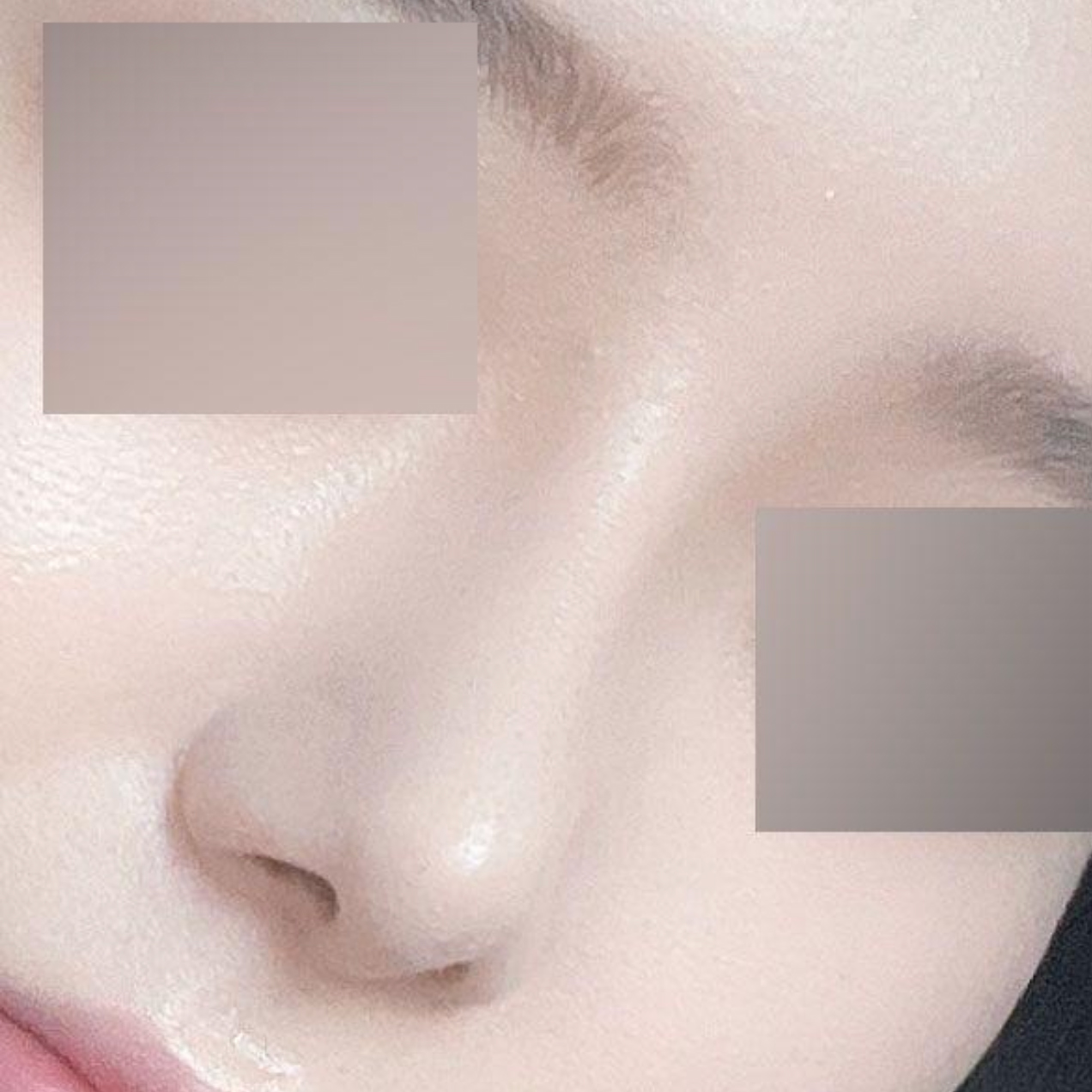 已經手術一個月了