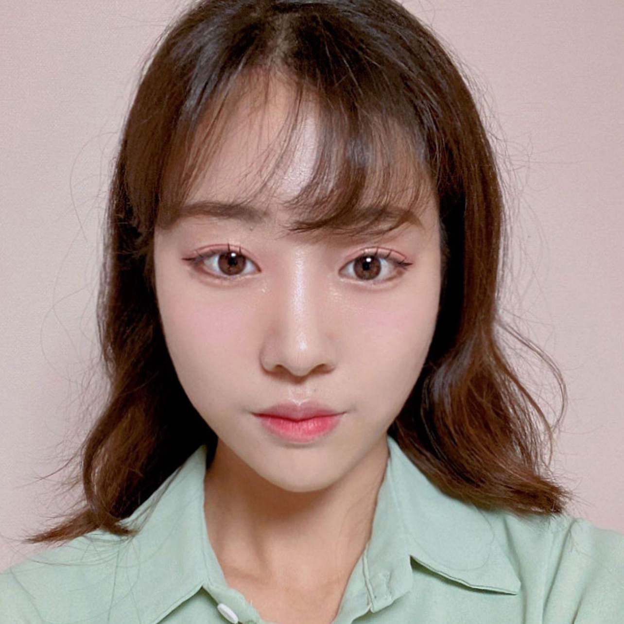 一個月了，消腫效果非常好ㅎㅎ