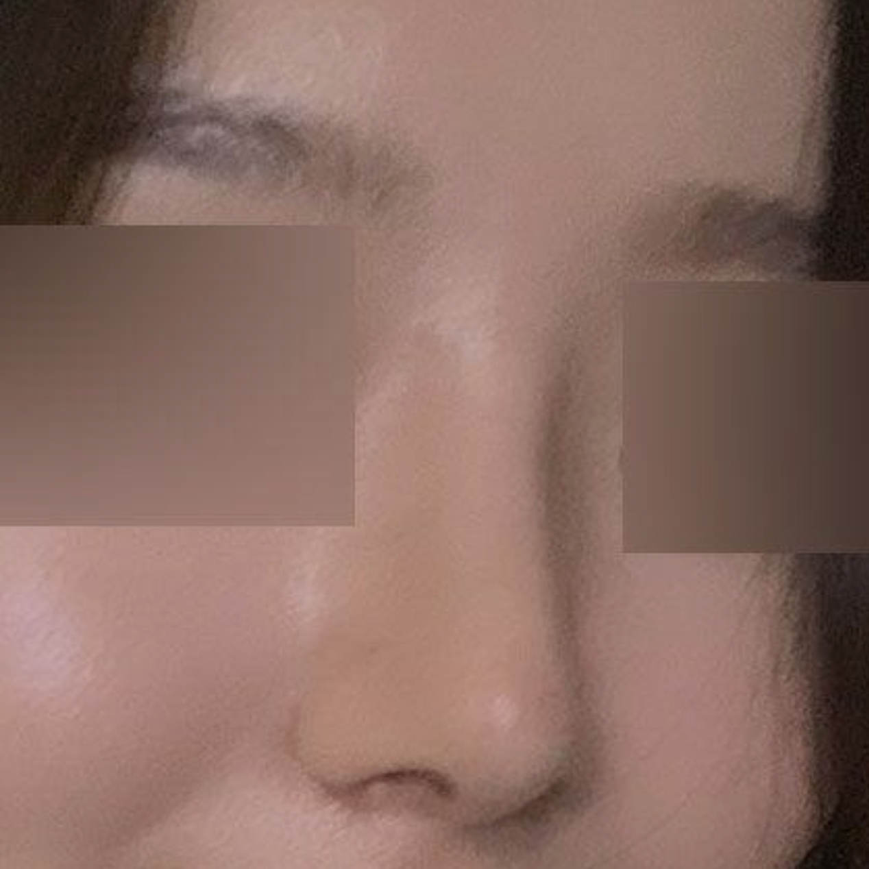 在Weverse做手術終於兩個月了