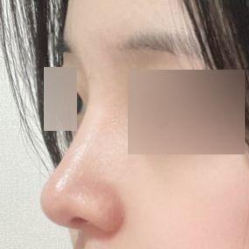 在Weverse做手術已經3個月了