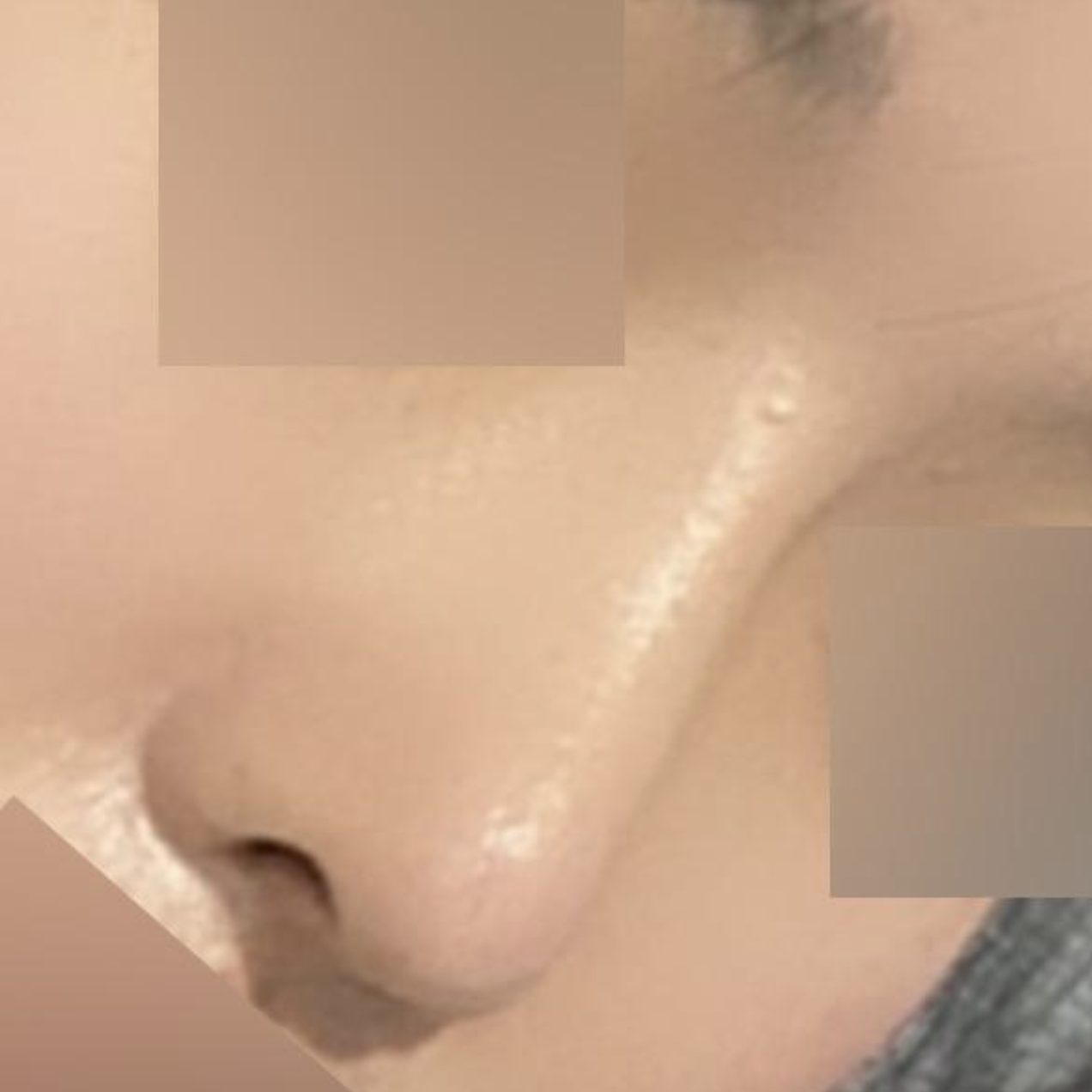 留下鼻整形手術的後記