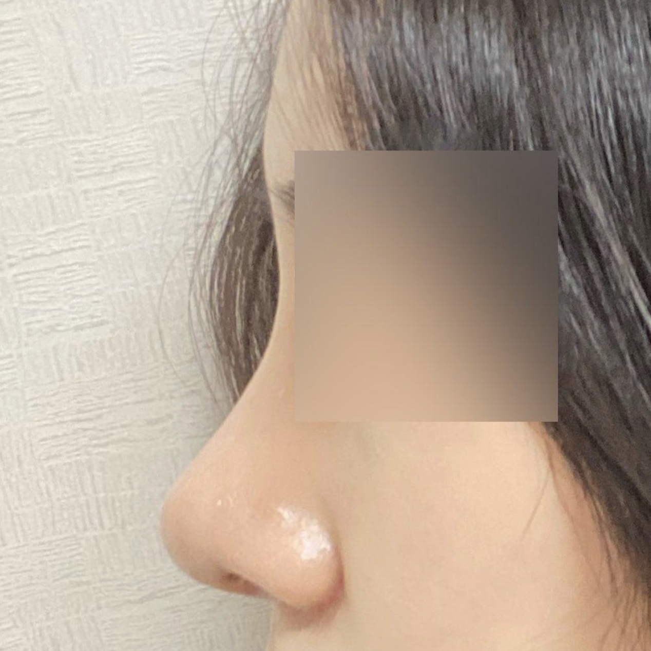 因為是朋友做過手術的地方，所以很信任（笑）