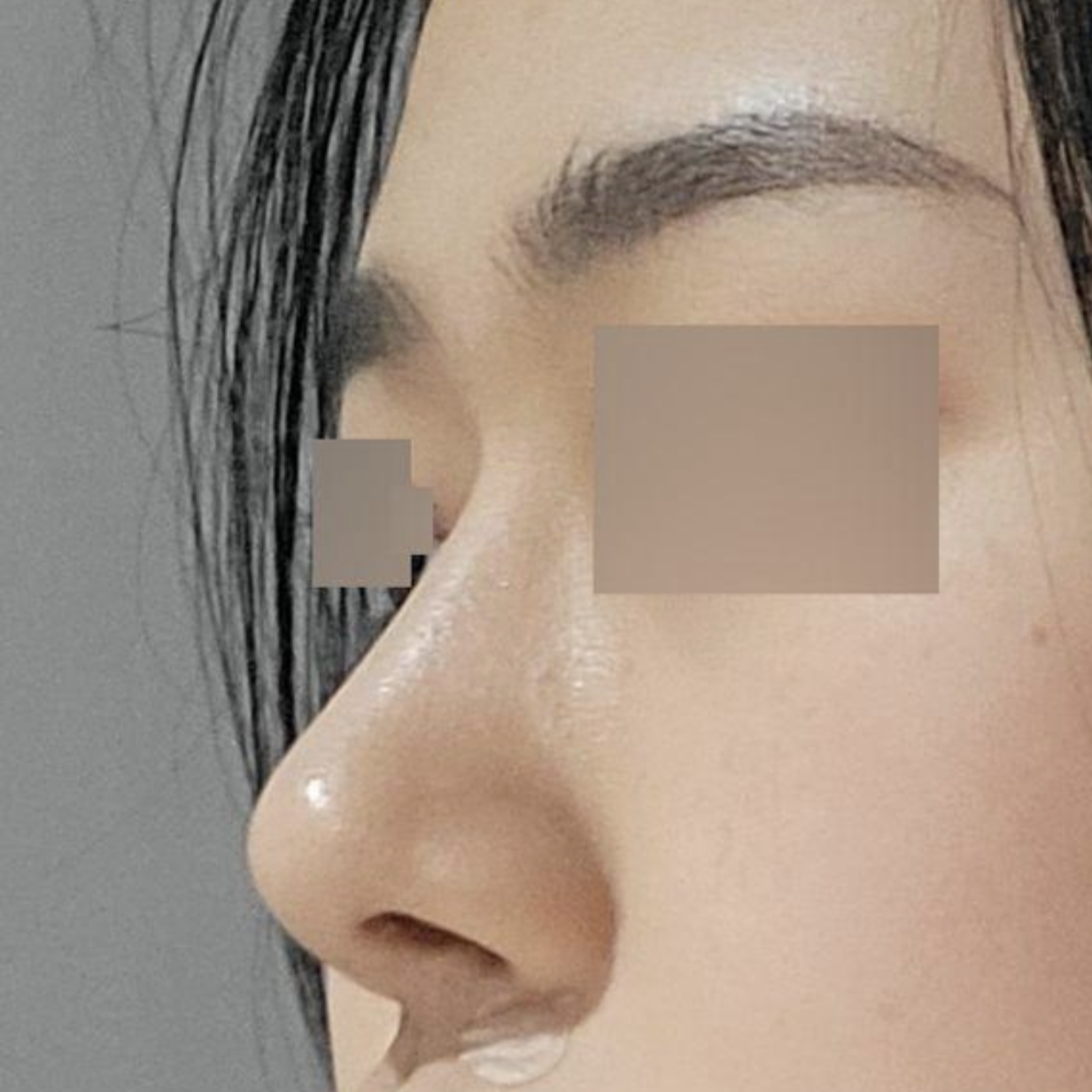 在Weverse做手術已經5個月了