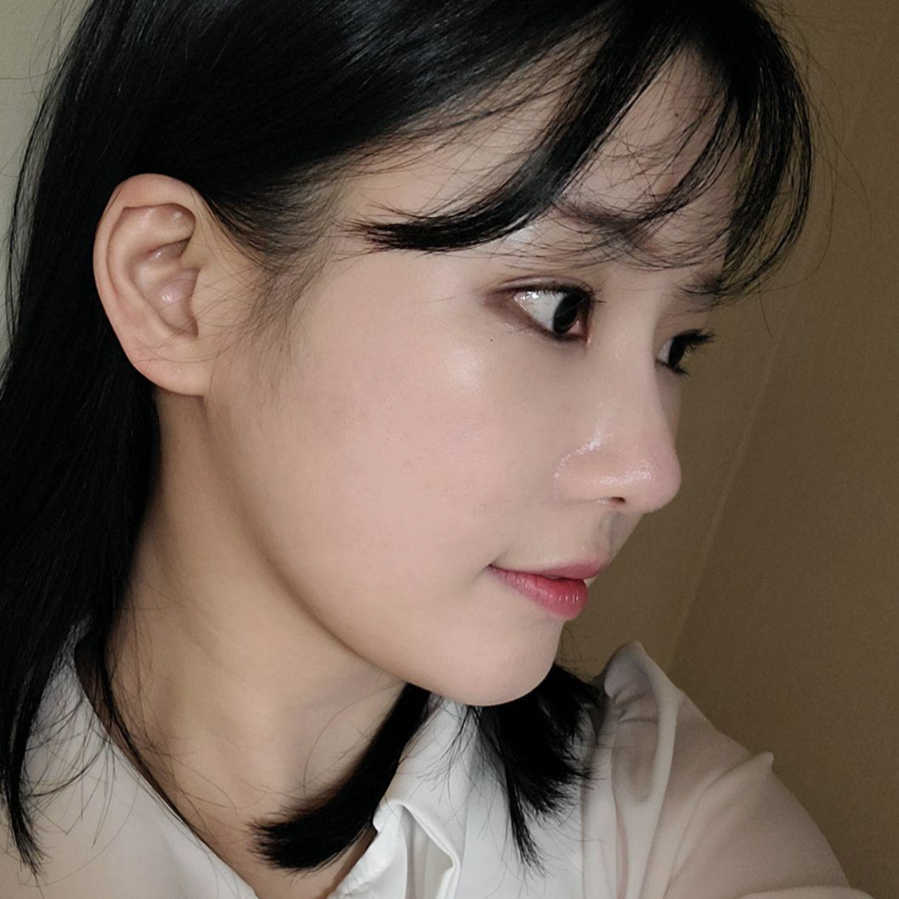 在維弗斯整形外科做眼鼻重修手術已經2個月了