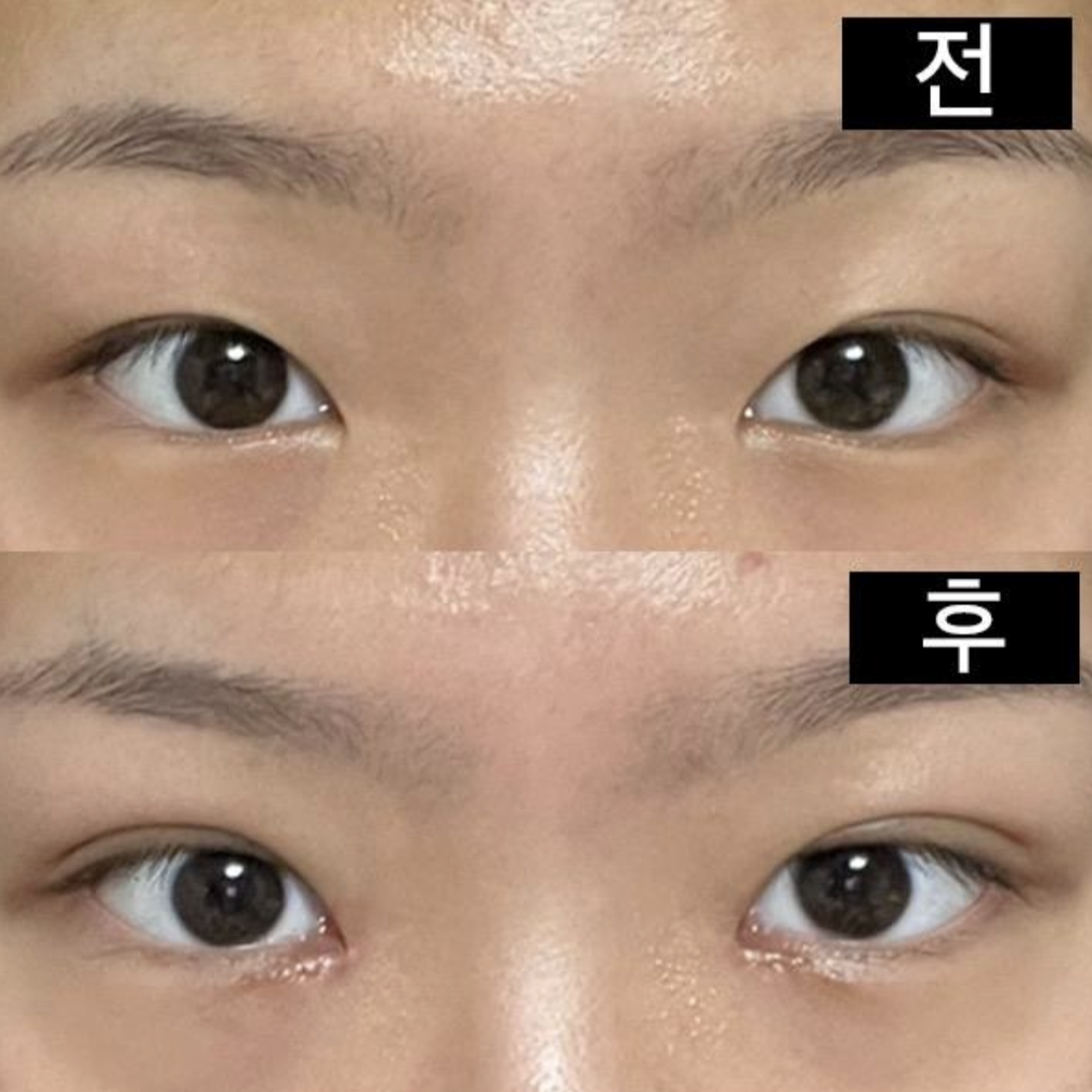 前後都是用基本相機拍攝的！