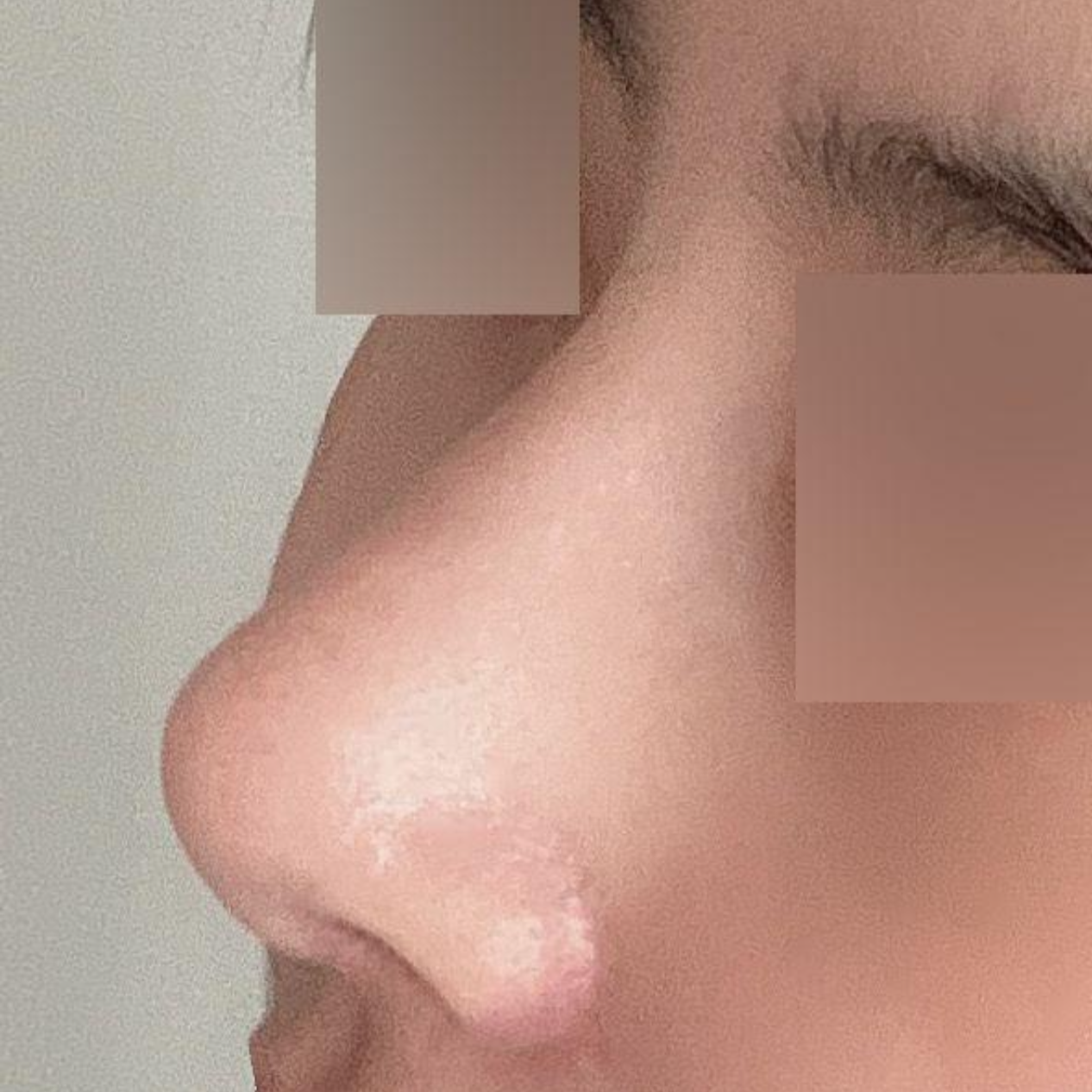 現在好像完全和蒜頭鼻告別了哈哈