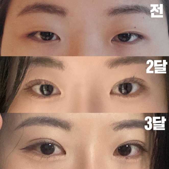 已經三個月了，看起來非常自然