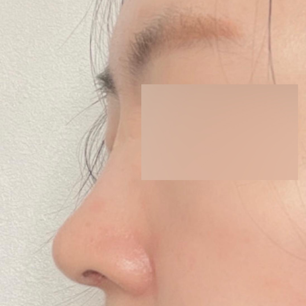 變得太漂亮了，素顏也變得自信了