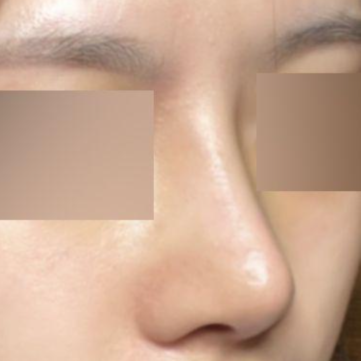 雖然是第一次手術，但感覺非常成功