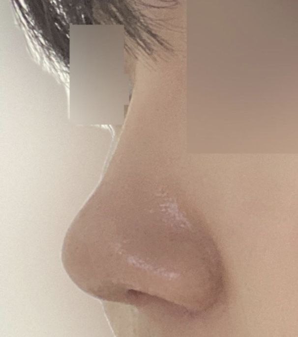 很滿意，看起來很自然