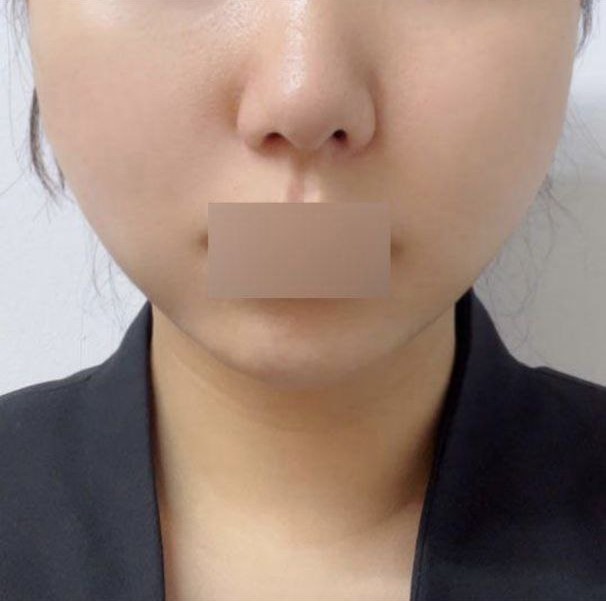 做線雕拉提真是神來之筆