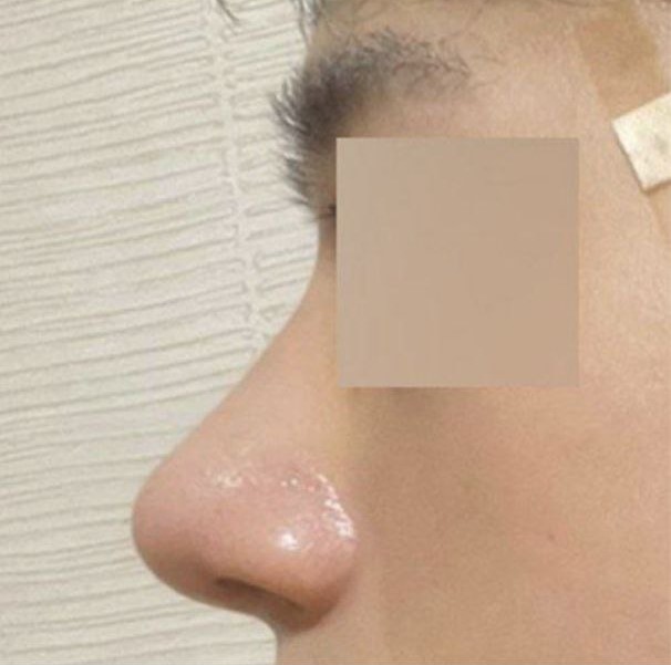 他們非常仔細地檢查並向我解釋！