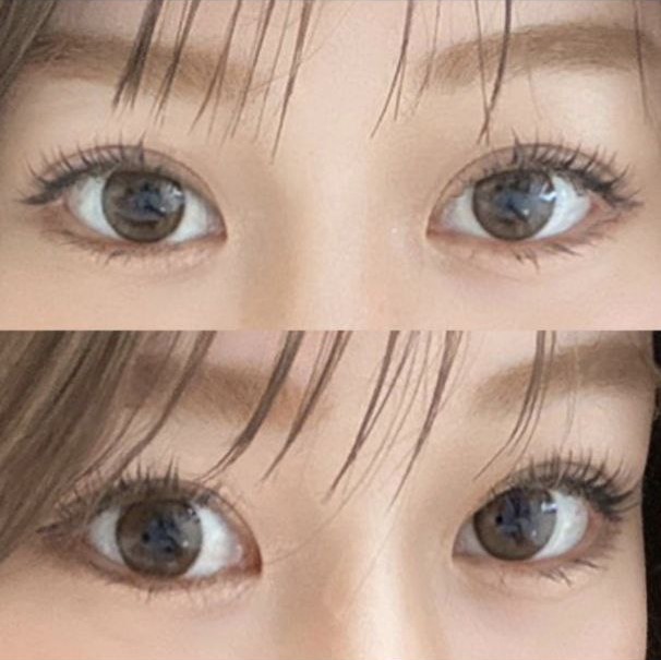 沒有過度診療，手術後也照顧得非常好ㅎㅎㅎ