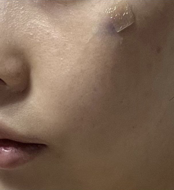 感覺自然地改善了在意的部位!