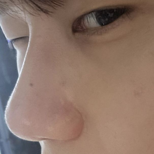 我覺得手術做得很好，謝謝。