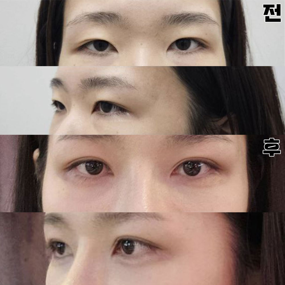 做出了非常纖細自然的線條