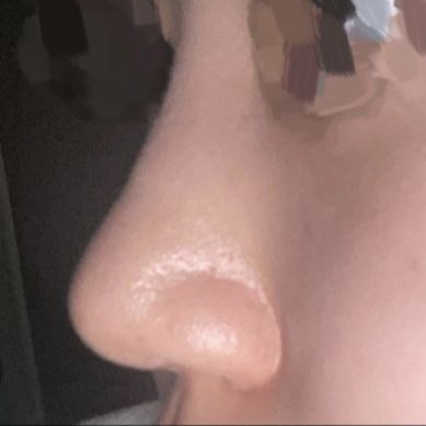 太好了ㅠㅠㅠ 謝謝院長..