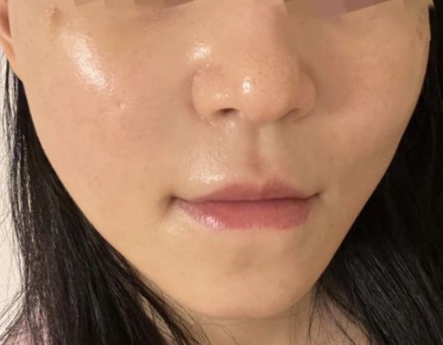 院長真的很仔細地看診！