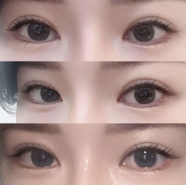 如果需要重做手術，大家都去Weverse吧！！哈哈哈