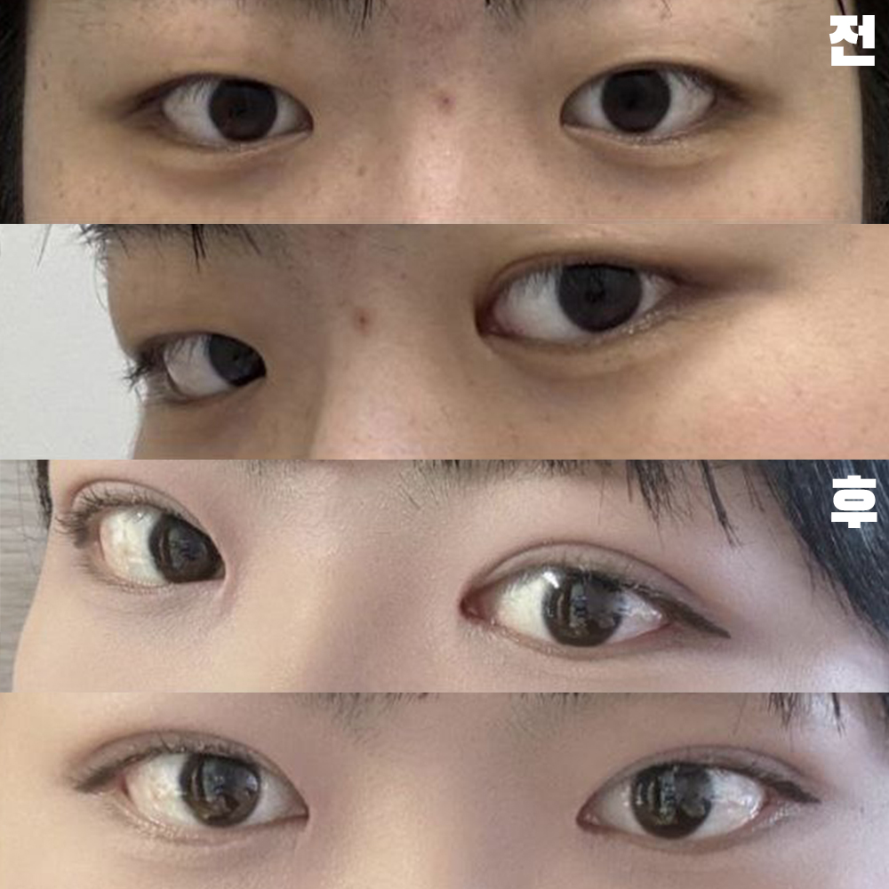 感謝您細心地為我治療，不讓我感到疼痛。