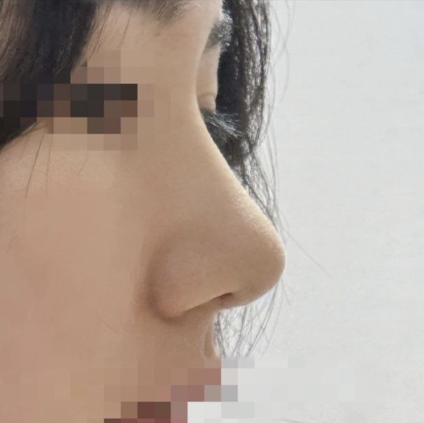 早知道就該早點做了ㅠㅠ