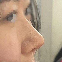 現在滿意度太高了，總是照鏡子感嘆...