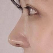 感謝您為我打造美麗的眼睛和鼻子