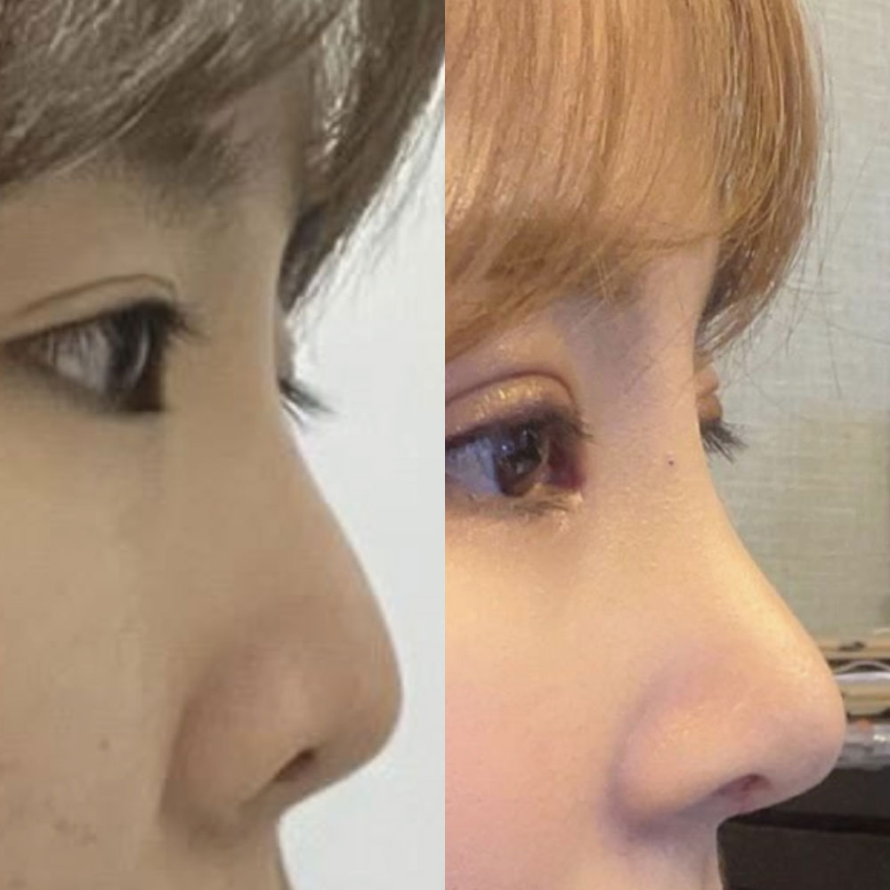 做了鼻部重修手術找了徐院長，做了眼部重修手術找了沈院長