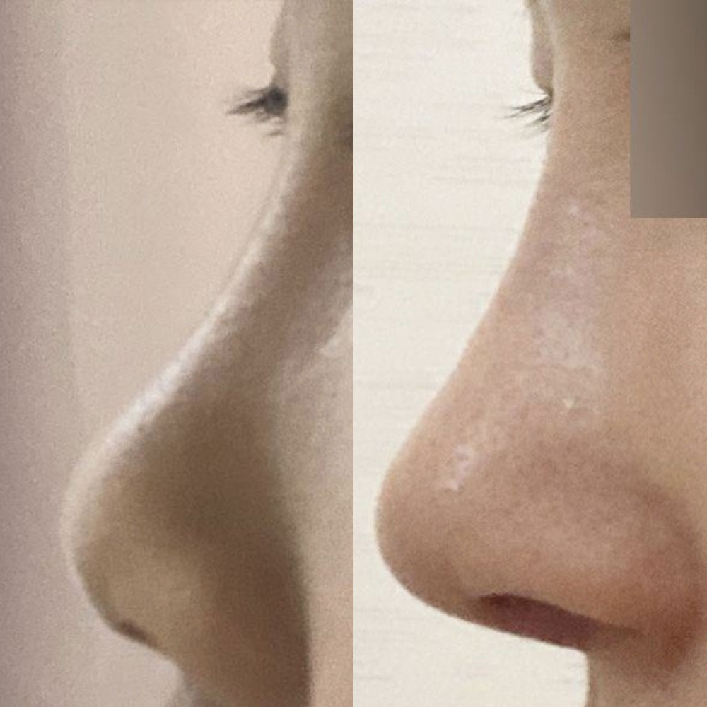 給沈正煥院長做手術已經兩週了